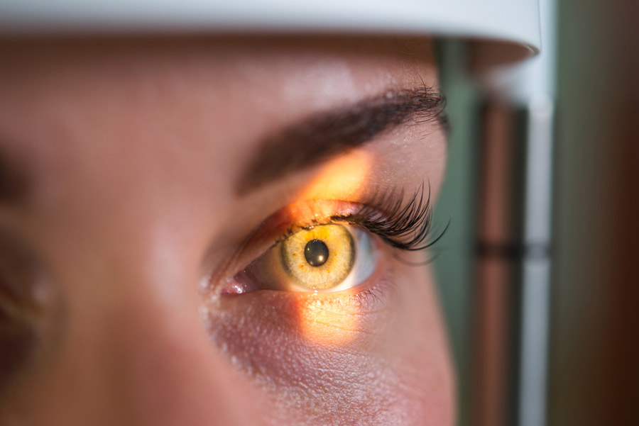 Augendiagnose in Kassel